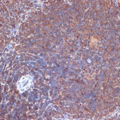 Immunohistochemistry-Paraffin: PI 3-Kinase p110 delta Antibody (3J0F6) [NBP3-15889]