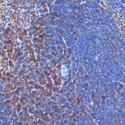Immunohistochemistry-Paraffin: PI 3-Kinase p110 delta Antibody (3J0F6) [NBP3-15889]