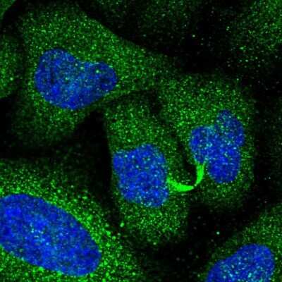 Immunocytochemistry/ Immunofluorescence: PI 3-Kinase p110 delta Antibody [NBP2-38535]