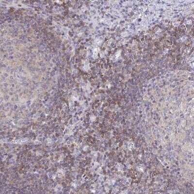 Immunohistochemistry-Paraffin: PI 3-Kinase p110 delta Antibody [NBP2-38535]