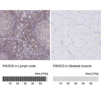 Immunohistochemistry-Paraffin: PI 3-Kinase p110 delta Antibody [NBP2-38535]