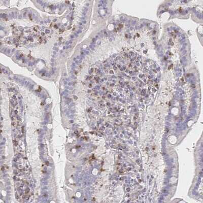 Immunohistochemistry-Paraffin: PI 3-Kinase p110 delta Antibody [NBP2-38535]