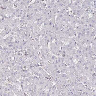 Immunohistochemistry-Paraffin: PI 3-Kinase p110 delta Antibody [NBP2-38535]