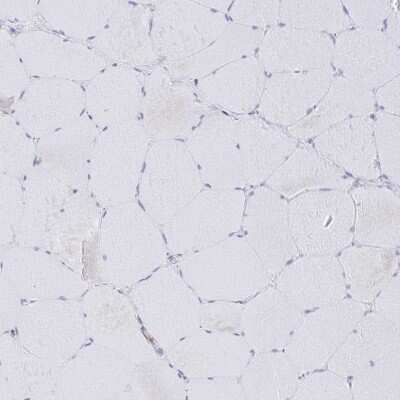 Immunohistochemistry-Paraffin: PI 3-Kinase p110 delta Antibody [NBP2-38535]