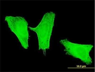 Immunocytochemistry/ Immunofluorescence: PI 3-Kinase p110 gamma Antibody (2G3) [H00005294-M02]