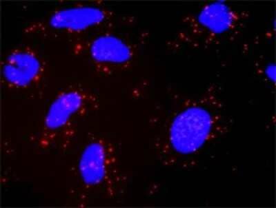 Proximity Ligation Assay: PI 3-Kinase p110 gamma Antibody (2G3) [H00005294-M02]