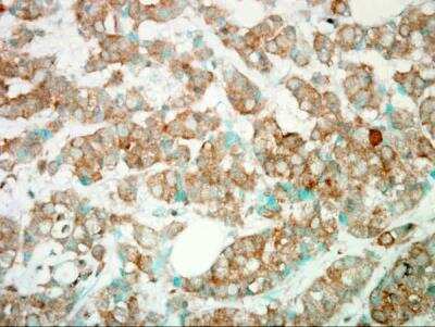 Immunohistochemistry-Paraffin: PI 3-Kinase p110 gamma Antibody [NBP2-15071]