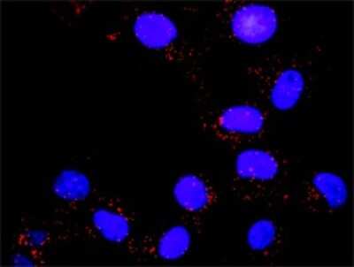 Proximity Ligation Assay: PI 3-Kinase p85 alpha Antibody (3A10) [H00005295-M01]