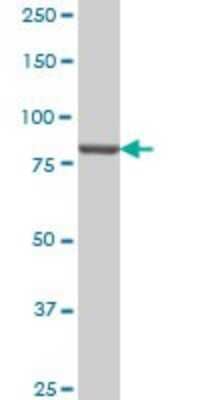 Western Blot: PI 3-Kinase p85 alpha Antibody (3A10) [H00005295-M01]