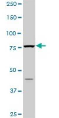Western Blot: PI 3-Kinase p85 alpha Antibody (3A10) [H00005295-M01]