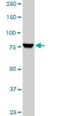 Western Blot: PI 3-Kinase p85 alpha Antibody (3A10) [H00005295-M01]