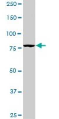 Western Blot: PI 3-Kinase p85 alpha Antibody (3A10) [H00005295-M01]