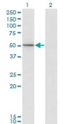 Western Blot: PI 3-Kinase p85 alpha Antibody (3A10) [H00005295-M01]