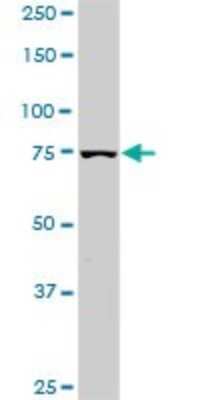 Western Blot: PI 3-Kinase p85 alpha Antibody (3C11) [H00005295-M03]