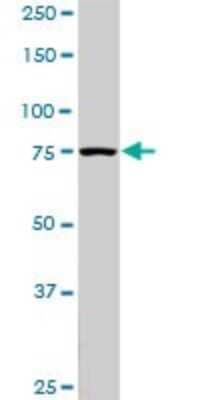 Western Blot: PI 3-Kinase p85 alpha Antibody (3C11) [H00005295-M03]