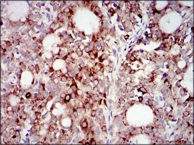 Immunohistochemistry-Paraffin: PI 3-Kinase p85 alpha Antibody (6G10) - BSA Free [NBP2-22212]