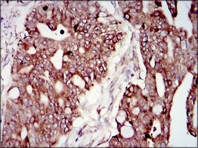 Immunohistochemistry-Paraffin: PI 3-Kinase p85 alpha Antibody (6G10) - BSA Free [NBP2-22212]
