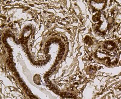 Immunohistochemistry-Paraffin: PI 3-Kinase p85 alpha Antibody (A3-D0) [NBP2-67058]