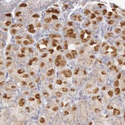 Immunohistochemistry-Paraffin: PI 3-Kinase p85 alpha Antibody [NBP1-89731]