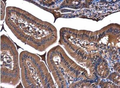 Immunohistochemistry-Paraffin: PI 3-Kinase p85 alpha Antibody [NBP2-19815]