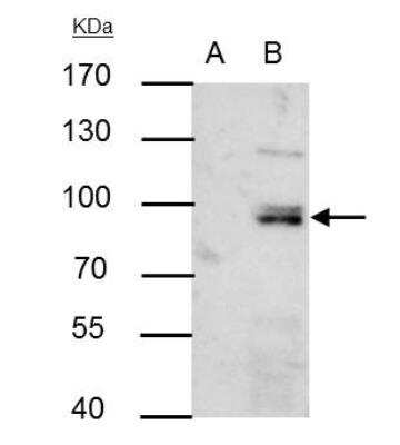 Immunoprecipitation: PI 3-Kinase p85 alpha Antibody [NBP2-19815]