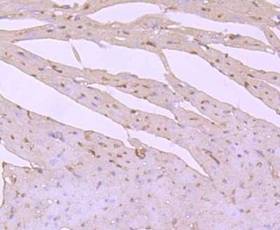 Immunohistochemistry-Paraffin: PI 3-Kinase p85 alpha Antibody (SU04-07) [NBP2-67488]