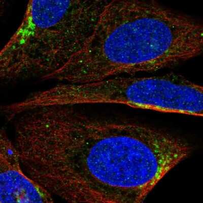 Immunocytochemistry/ Immunofluorescence: PI 3-Kinase p85 beta Antibody [NBP2-56360]