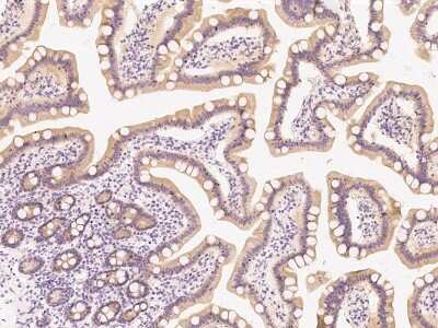 Immunohistochemistry: PI 3-Kinase p85 beta Antibody [NBP2-99487]