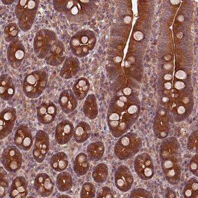 Immunohistochemistry-Paraffin: PI 3-Kinase p85 beta Antibody [NBP2-56360]