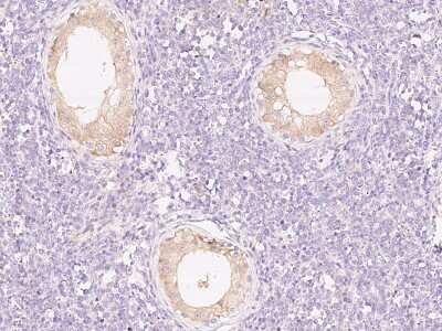 Immunohistochemistry-Paraffin: PI 3-Kinase p85 beta Antibody [NBP2-99487]