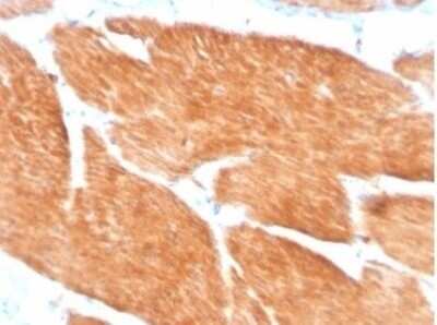 Immunohistochemistry-Paraffin: PI 3-Kinase p85 beta Antibody (PIK3R2/1293) [NBP3-13736]
