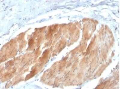 Immunohistochemistry-Paraffin: PI 3-Kinase p85 beta Antibody (PIK3R2/1293) [NBP3-13736]