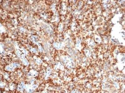 Immunohistochemistry-Paraffin: PI 3-Kinase p85 beta Antibody (PIK3R2/292) [NBP3-13735]
