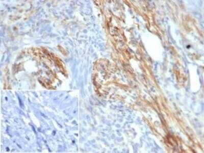 Immunohistochemistry-Paraffin: PI 3-Kinase p85 beta Antibody (PIK3R2/292) [NBP3-13735]