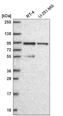 Western Blot: PI 3-Kinase p85 beta Antibody [NBP2-56360]