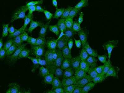 Immunocytochemistry/ Immunofluorescence: PI 4 Kinase type 2 beta Antibody [NBP2-97902]