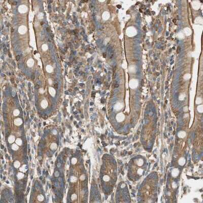 Immunohistochemistry-Paraffin: PI 4 Kinase type 2 beta Antibody [NBP1-87908]