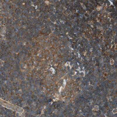 Immunohistochemistry-Paraffin: PI 4 Kinase type 2 beta Antibody [NBP1-87908]