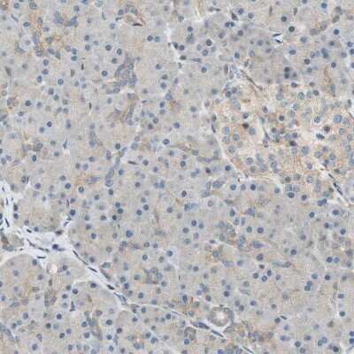 Immunohistochemistry-Paraffin: PI 4 Kinase type 2 beta Antibody [NBP1-87908]