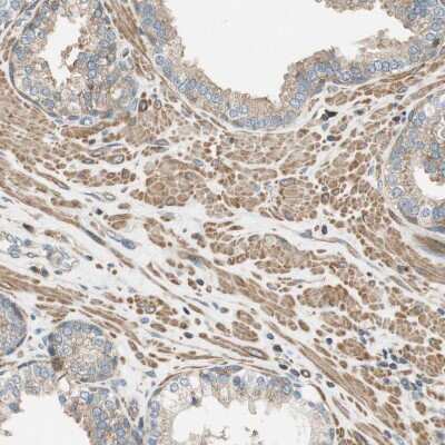 Immunohistochemistry-Paraffin: PI 4 Kinase type 2 beta Antibody [NBP1-87908]