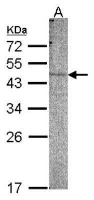 Western Blot: PI 4 Kinase type 2 beta Antibody [NBP1-32263]