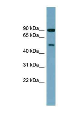 Western Blot: PI 4 Kinase type 2 beta Antibody [NBP1-56547]