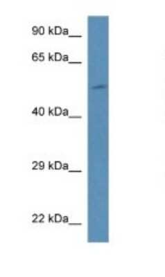 Western Blot: PI 4 Kinase type 2 beta Antibody [NBP1-74233]