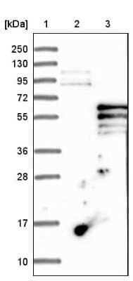 Western Blot: PI 4 Kinase type 2 beta Antibody [NBP1-87908]