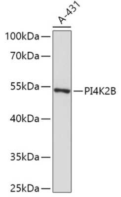 Western Blot: PI 4 Kinase type 2 beta AntibodyAzide and BSA Free [NBP2-94379]