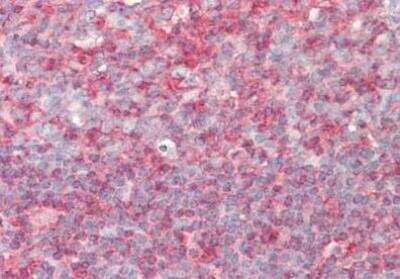 Immunohistochemistry-Paraffin: PIP5K1 alpha Antibody [NBP2-44148]