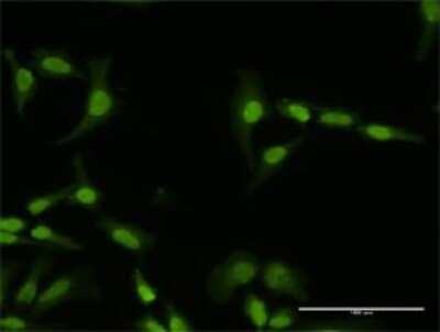 Immunocytochemistry/ Immunofluorescence: PI4K2A Antibody [H00055361-D01P]