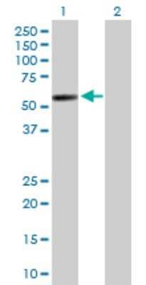 Western Blot: PI4K2A Antibody [H00055361-D01P]