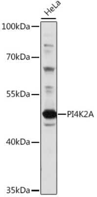 Western Blot: PI4K2A AntibodyAzide and BSA Free [NBP2-94647]