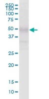 Western Blot: PI4KAP2 Antibody [H00375133-B01P]